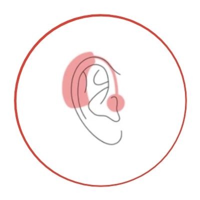 Schéma d'une oreille avec un appareil auditif de type BTE